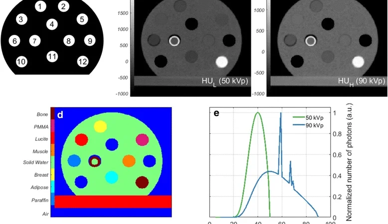 Do traditional cylindrical phantoms overestimate accuracy in iodine quantification in Photon Counting CT?