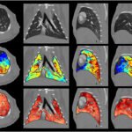 K-Edge Imaging: How PCCT Told Xenon From Gadolinium