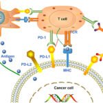 Photon-Counting CT and PD-L1 Prediction in Non Small Cell Lung Cancer (NSCLC)