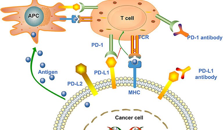 Photon-Counting CT and PD-L1 Prediction in Non Small Cell Lung Cancer (NSCLC)