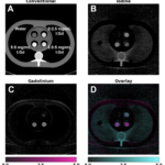 K-Edge Imaging on Photon-Counting CT: A Phantom Preprint