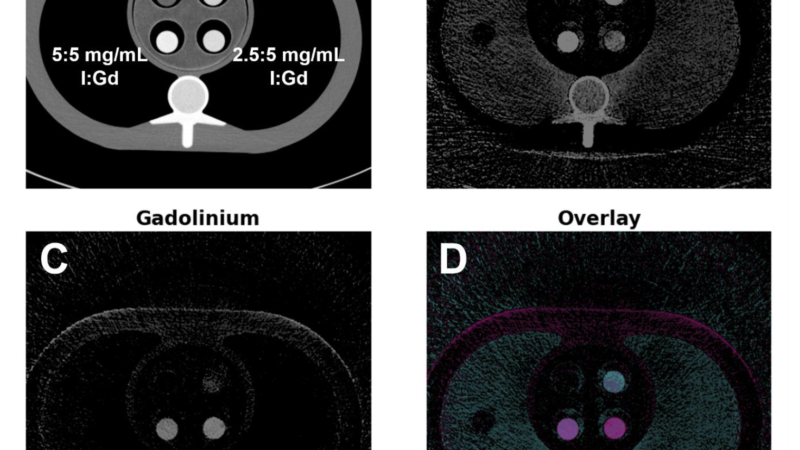 K-Edge Imaging on Photon-Counting CT: A Phantom Preprint